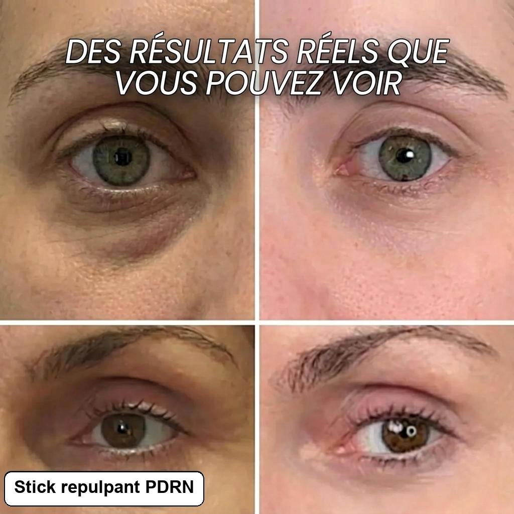 Stick repulpant bio-collagène PDRN