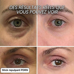Stick repulpant bio-collagène PDRN