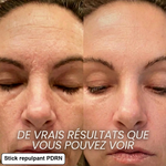 Stick repulpant bio-collagène PDRN