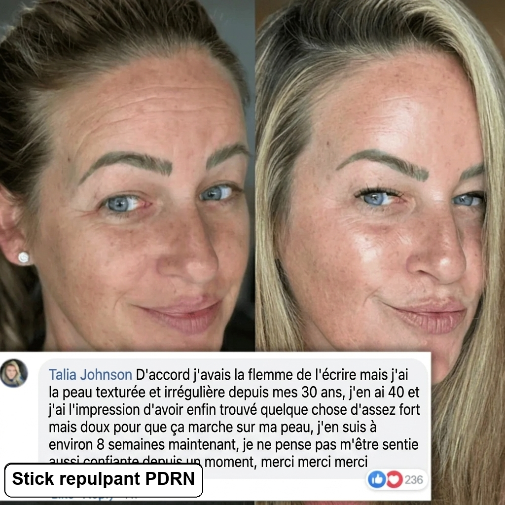Stick repulpant bio-collagène PDRN