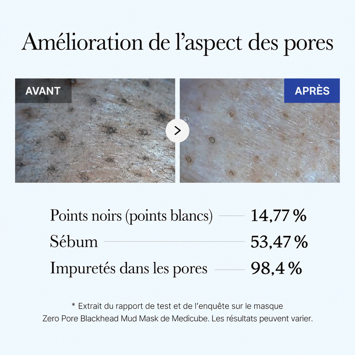 Résultats rapportés par Medicube sur l’aspect des pores