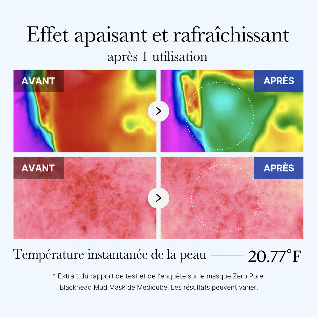 Effet rafraîchissant rapporté par Medicube
