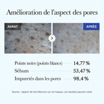 Amélioration de l’aspect des pores — rapport de test Mevorys, résultats variables